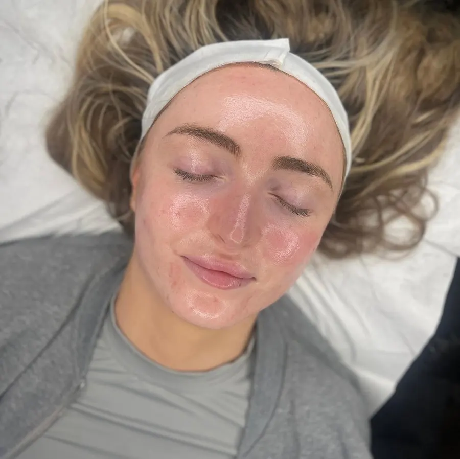 After an Ultimate Luxury Facial at Skin9 Studio, Oakville